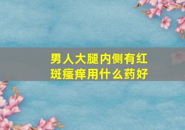 男人大腿内侧有红斑瘙痒用什么药好