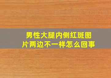 男性大腿内侧红斑图片两边不一样怎么回事