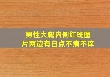 男性大腿内侧红斑图片两边有白点不痛不痒