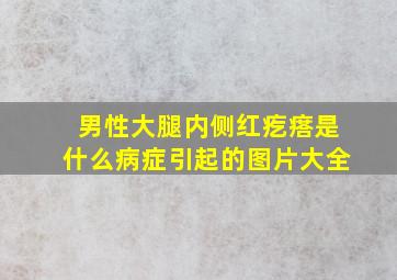 男性大腿内侧红疙瘩是什么病症引起的图片大全