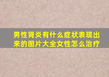 男性肾炎有什么症状表现出来的图片大全女性怎么治疗