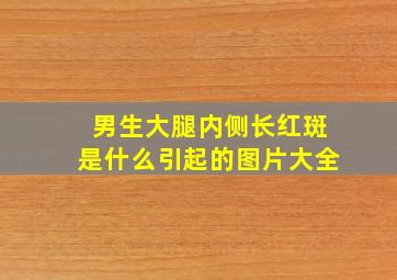 男生大腿内侧长红斑是什么引起的图片大全