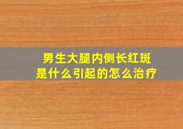 男生大腿内侧长红斑是什么引起的怎么治疗