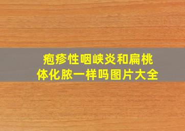 疱疹性咽峡炎和扁桃体化脓一样吗图片大全