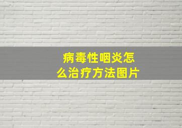 病毒性咽炎怎么治疗方法图片