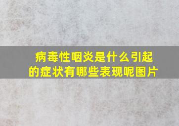 病毒性咽炎是什么引起的症状有哪些表现呢图片