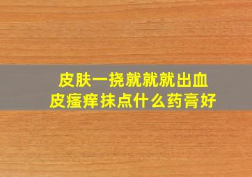 皮肤一挠就就就出血皮瘙痒抹点什么药膏好