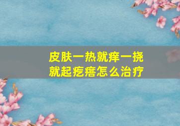 皮肤一热就痒一挠就起疙瘩怎么治疗