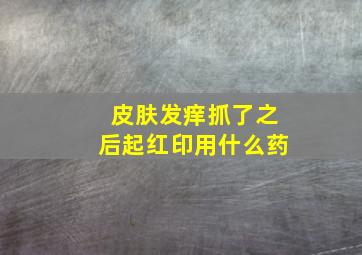 皮肤发痒抓了之后起红印用什么药