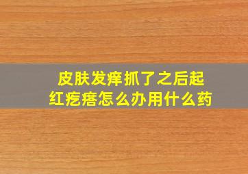 皮肤发痒抓了之后起红疙瘩怎么办用什么药