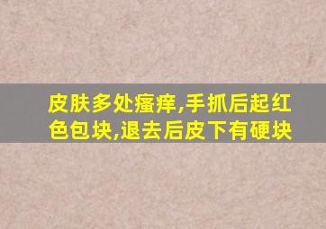 皮肤多处瘙痒,手抓后起红色包块,退去后皮下有硬块