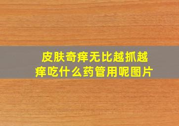 皮肤奇痒无比越抓越痒吃什么药管用呢图片