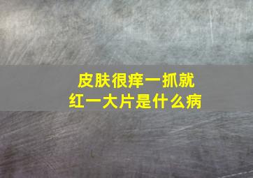 皮肤很痒一抓就红一大片是什么病