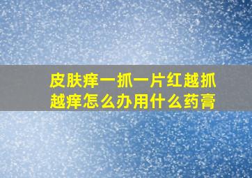 皮肤痒一抓一片红越抓越痒怎么办用什么药膏