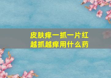 皮肤痒一抓一片红越抓越痒用什么药