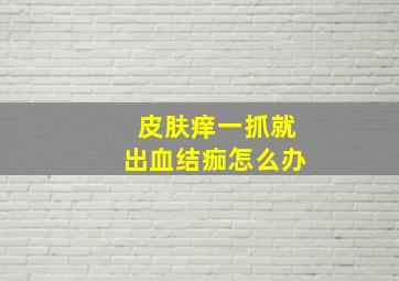 皮肤痒一抓就出血结痂怎么办