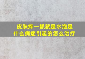 皮肤痒一抓就是水泡是什么病症引起的怎么治疗