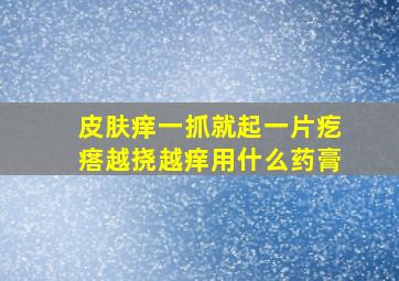 皮肤痒一抓就起一片疙瘩越挠越痒用什么药膏