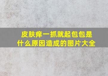 皮肤痒一抓就起包包是什么原因造成的图片大全