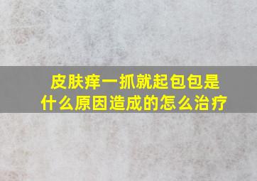 皮肤痒一抓就起包包是什么原因造成的怎么治疗