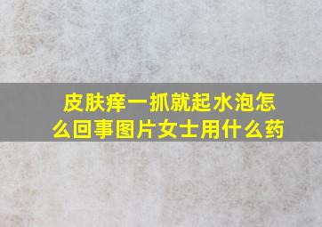 皮肤痒一抓就起水泡怎么回事图片女士用什么药