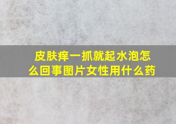 皮肤痒一抓就起水泡怎么回事图片女性用什么药