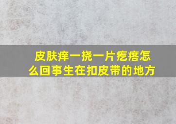 皮肤痒一挠一片疙瘩怎么回事生在扣皮带的地方