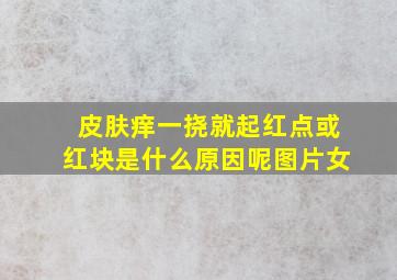 皮肤痒一挠就起红点或红块是什么原因呢图片女