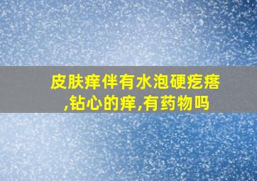 皮肤痒伴有水泡硬疙瘩,钻心的痒,有药物吗