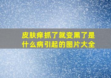 皮肤痒抓了就变黑了是什么病引起的图片大全