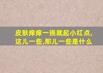 皮肤痒痒一挠就起小红点,这儿一些,那儿一些是什么