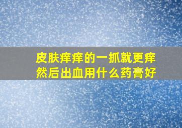 皮肤痒痒的一抓就更痒然后出血用什么药膏好