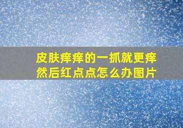 皮肤痒痒的一抓就更痒然后红点点怎么办图片