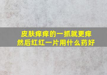 皮肤痒痒的一抓就更痒然后红红一片用什么药好