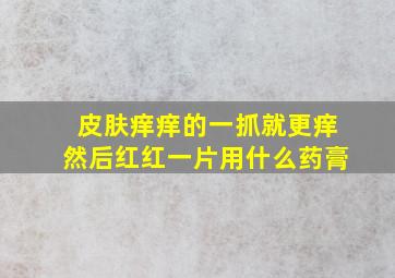 皮肤痒痒的一抓就更痒然后红红一片用什么药膏