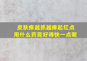 皮肤痒越抓越痒起红点用什么药膏好得快一点呢