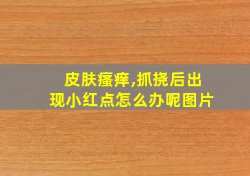 皮肤瘙痒,抓挠后出现小红点怎么办呢图片