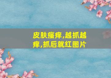 皮肤瘙痒,越抓越痒,抓后就红图片