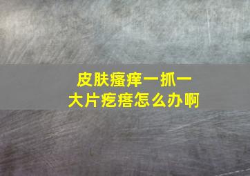 皮肤瘙痒一抓一大片疙瘩怎么办啊