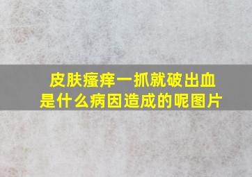 皮肤瘙痒一抓就破出血是什么病因造成的呢图片