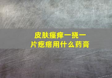 皮肤瘙痒一挠一片疙瘩用什么药膏