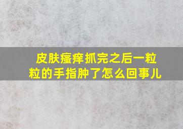 皮肤瘙痒抓完之后一粒粒的手指肿了怎么回事儿