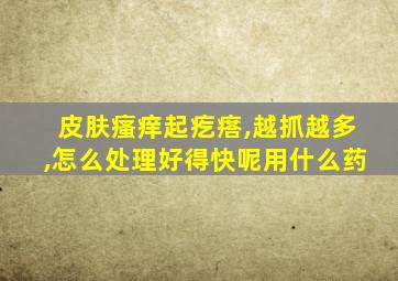 皮肤瘙痒起疙瘩,越抓越多,怎么处理好得快呢用什么药