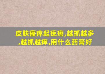 皮肤瘙痒起疙瘩,越抓越多,越抓越痒,用什么药膏好