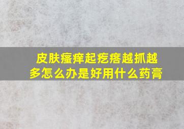 皮肤瘙痒起疙瘩越抓越多怎么办是好用什么药膏