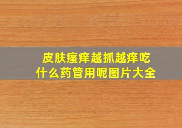 皮肤瘙痒越抓越痒吃什么药管用呢图片大全