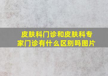 皮肤科门诊和皮肤科专家门诊有什么区别吗图片