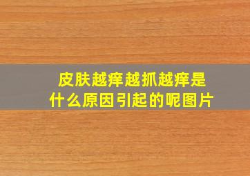 皮肤越痒越抓越痒是什么原因引起的呢图片