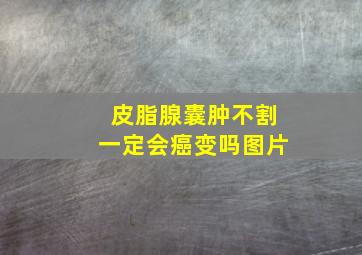 皮脂腺囊肿不割一定会癌变吗图片