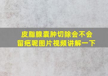 皮脂腺囊肿切除会不会留疤呢图片视频讲解一下